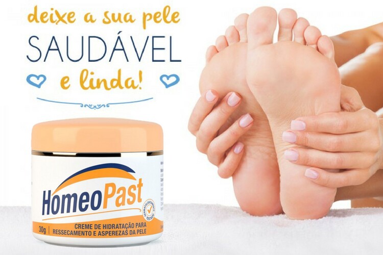 Psoríase: uma doença crônica da pele!